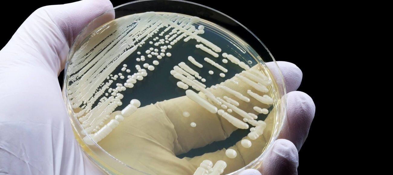 antifungal disinfectant testing against drug-resistant Candida auris