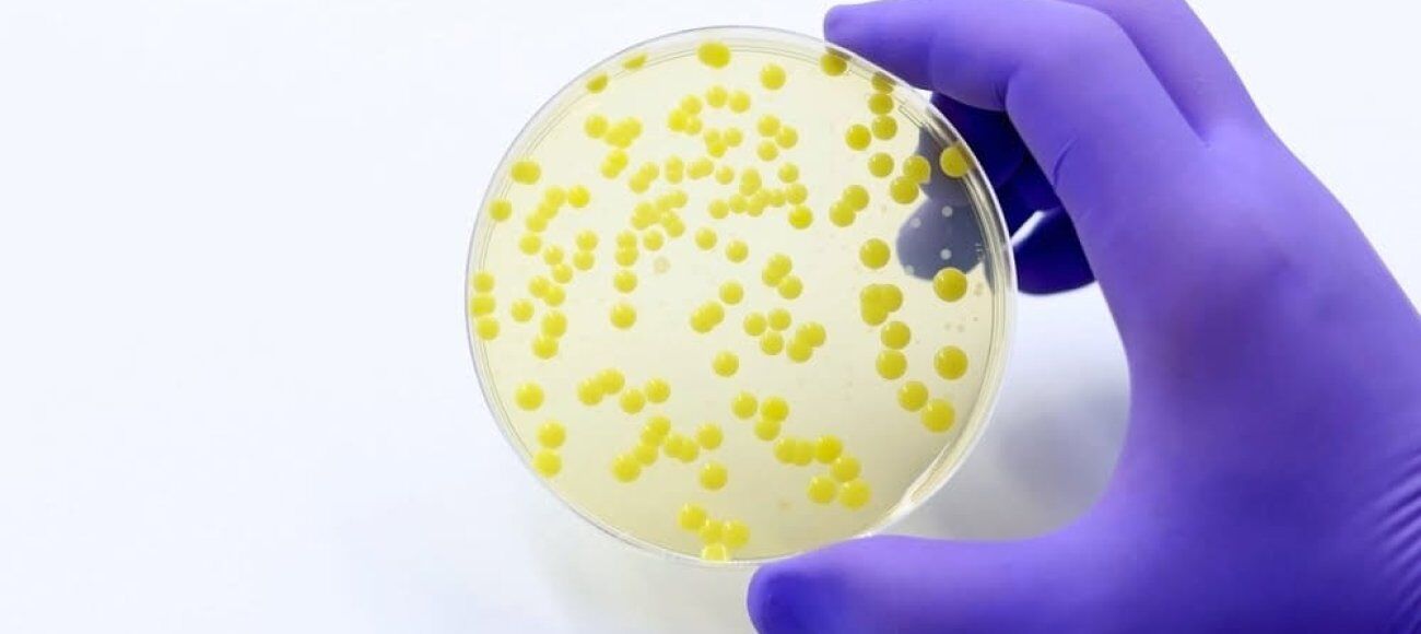 USP 61: Microbial Enumeration Tests